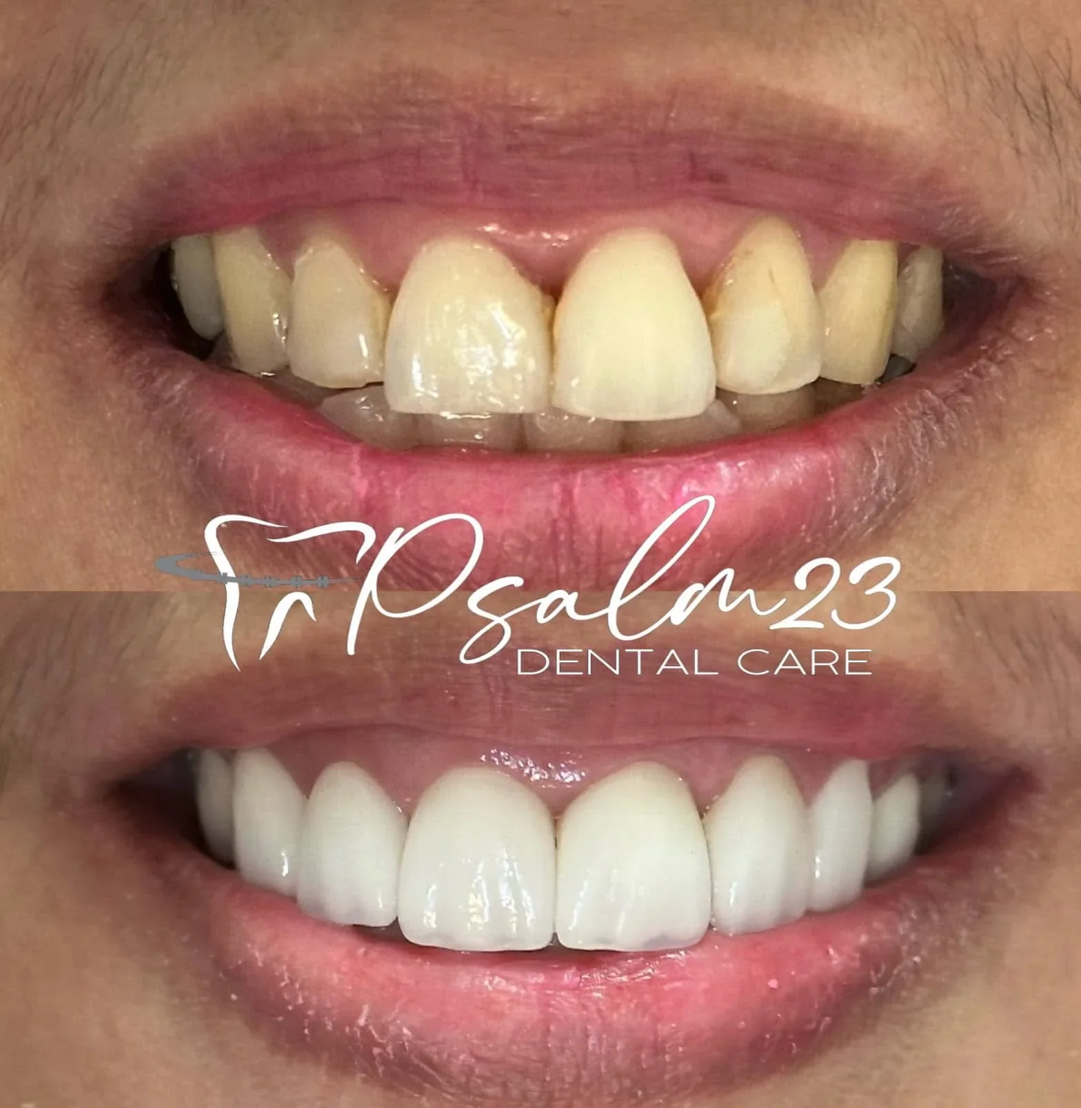 Psalm23 Dental Care cosmetic dentistry services — photo 5